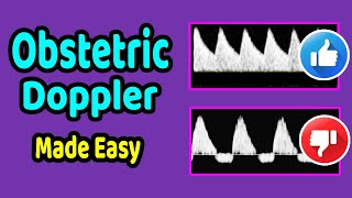 Obstetric Doppler Made Easy [upl. by Boffa]