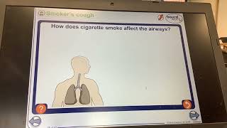 KS4GCSEBIOLOGYHow smoking effects airways [upl. by Aseen]