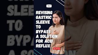 Revising Gastric Sleeve to Bypass  A Solution for Acid Reflux [upl. by Attenev]