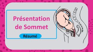 La présentation du sommet 👶Tout savoir sur laccouchement 🤓  Résumé  Gynécoobstétrique [upl. by Brynn]