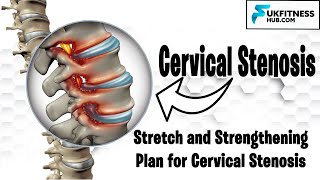 Complete Cervical Stenosis Exercises and Stretch Plan For Pain Management and Postural Correction [upl. by Namzzaj573]