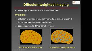 Liver metastases  what the radiologist needs to know W Schima [upl. by Hines559]