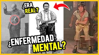 La triste historia de la GARROTERA del Chavo del 8 ¿ES UNA ENFERMEDAD REAL INCREÍBLE CRONOS FILMS [upl. by Drarej]