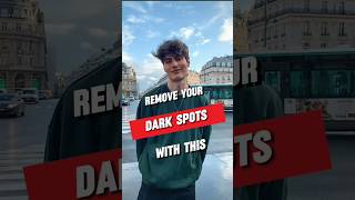 Remove your Dark spots at home with this  Day 14  How to remove dark spots at home [upl. by Sprung147]