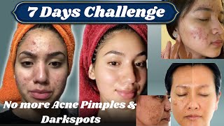 Home remedy to remove Dark Spots  7 days challenge⏳ Scar Treatment  Glam Bar by Fatima [upl. by Idola]