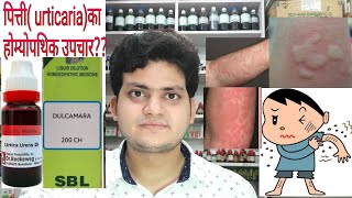 Urticaria Homeopathic medicine for Urticaria explain [upl. by Willner]