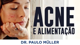 Acne e Alimentação – Alimentos Causam Espinhas – Dr Paulo Müller Dermatologista [upl. by Naihs25]