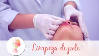 Limpeza de pele tratamento estético elimina cravos e milium [upl. by Amesari905]