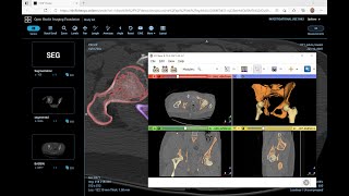 Using 3D Slicer with cloud DICOMweb databases [upl. by Gentilis]