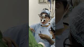 Rhinoplasty Surgery in Delhi  Dr Monisha Kapoor  Nose Surgery Before amp After shorts ytshorts [upl. by Noislla]