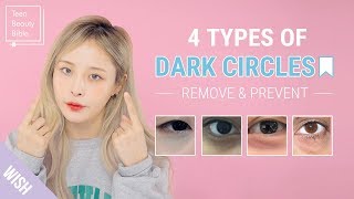 How to Remove Dark Circles Under Eyes In The Most Effective Way  Teen Beauty Bible [upl. by Lenka]