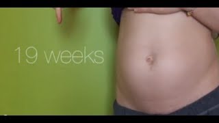 19 Weeks Pregnant  Food Troubles 7lbs Anatomy Scan BAD SKIN [upl. by Sucerdor63]