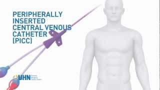 Learn About the Peripherally Inserted Central Venous Catheter PICC [upl. by Conni]