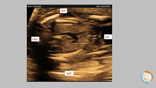 Demonstrating Fetal NRSA [upl. by Trout]