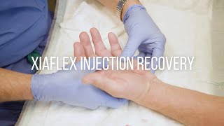 Dupuytrens Contracture Injection Recovery Instructions [upl. by Ynotna872]