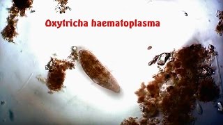 Oxytricha haematoplasma [upl. by Jardena]