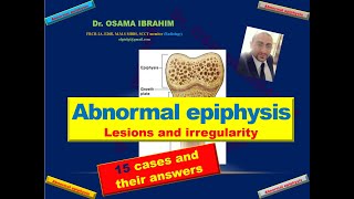 Abnormal epiphysis 15 cases with their answers [upl. by Netsua]