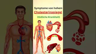 Symptome von hohem cholesterinspiegel [upl. by Mroz]