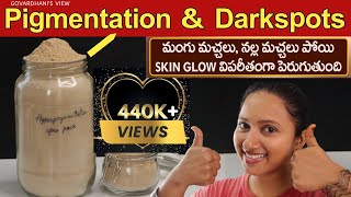 Pigmentation treatment on face at home in Telugu  Melasma Dark Spots amp Acne Spots Govardhani [upl. by Aimehs683]