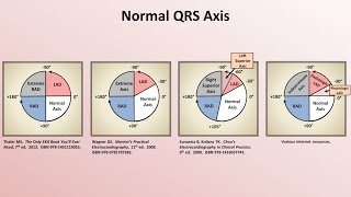 Intro to EKG Interpretation  Rate and Axis [upl. by Ahsenrac681]