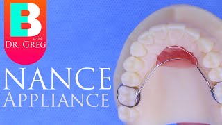 Nance Appliance during Braces [upl. by Nebe860]