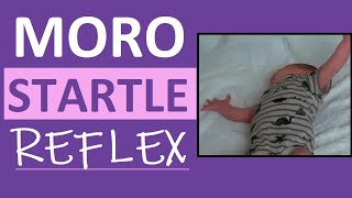 Moro Reflex Newborn Test  Startle Reflex  Pediatric Nursing Assessment [upl. by Hcirdeirf]