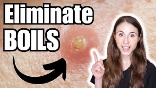 How To Get Rid Of Boils  Dermatologist Tips [upl. by Sara-Ann]