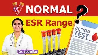 What is Normal Range of ESR  ESR Normal Kitna Hota Hai [upl. by Koloski705]