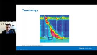 Analysis of Esophageal High Resolution Manometry Using Chicago Classification version 4 0 [upl. by Kermie286]