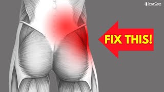 How to Fix OneSided Lower Back and Hip Pain [upl. by Allmon142]