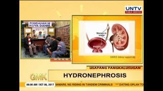 All about Hydronephrosis  Usapang Pangkalusugan [upl. by Aenej]