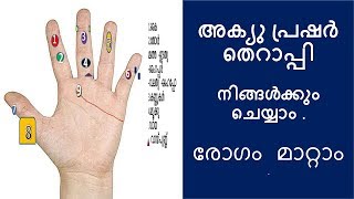 Acupressure treatment Malayalam  Acupressure points  Acupressure malayalam [upl. by Kroo]