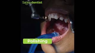 Professional Teeth Cleaning amp Polishing by Sabka Dentist Experts [upl. by Zoarah390]