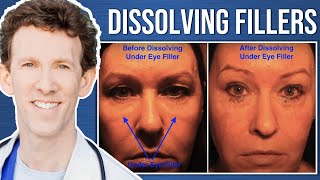 Reversing Bags Under the Eyes After Filler Injection [upl. by Dart]