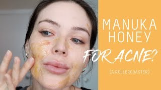 I tried manuka honey for acne  hyperpigmentation  Nicole Masifilo [upl. by Morrill]