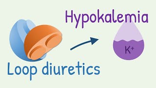 How diuretics cause hypokalemia [upl. by Antonetta]