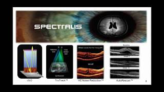 SPECTRALIS OCT  Approaching Optic Neuropathies [upl. by Birdt]