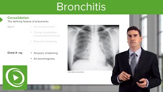 Pneumonia Introduction amp Types – Respiratory Medicine  Lecturio [upl. by Kristos]