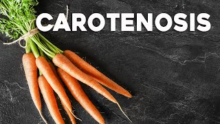 How Too Many Carrots Can Turn Your Skin Orange  Carotenosis  Corporis [upl. by Blane]