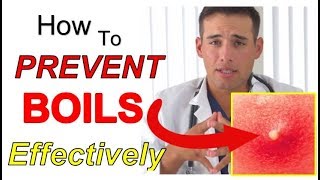 How to PREVENT Boils Effectively 4 STEPS  The Best Way to PREVENT Boils From Coming Back [upl. by Ness]