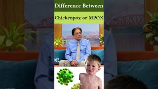 Chickenpox amp MPox Causes Symptoms amp Treatment  Dr Atif Kazmi Explains [upl. by Perot]