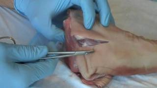 Suture  Basic Technique 1 [upl. by Ancell269]