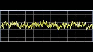 Inflammation  Rife Frequencies [upl. by Ellimac]