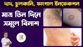 6 Home Remedies for Itching Problem In Private Parts Skin Fungal Infection দাদহাজাচুলকানি । [upl. by Edmond986]