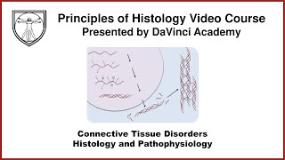 Connective Tissue Disorders Histology and Pathophysiology Connective Tissue Histology Part 3 of 3 [upl. by Ahsiral965]