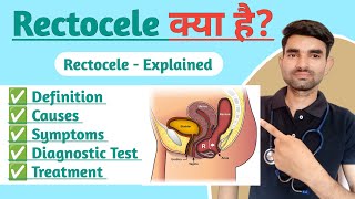 Rectocele Explained in Hindi  Causes Symptoms And Treatment of Rectocele [upl. by Oznole206]