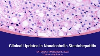 Clinical Updates in Nonalcoholic Steatohepatitis [upl. by Asa]