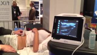 Ultrasound Guided Illeoingunal Nerve Block [upl. by Eloisa34]