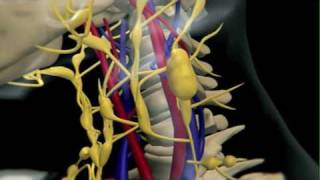 How Lymphoma Develops [upl. by Nnahgem]