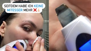 🚫👃 Mit dieser Methode Mitesser KOMPLETT entfernen  Einfacher gehts nicht  Mitesser loswerden [upl. by Charlene]